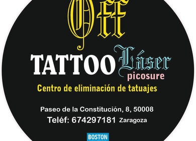 Off Tattoo-láser