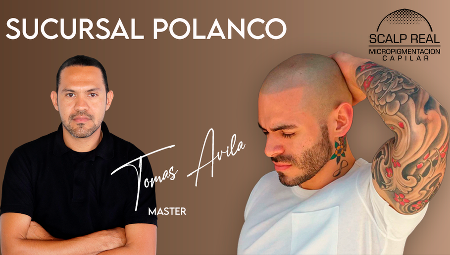 Micropigmentación Capilar No 1 en México - Scalp Real Studio CDMX