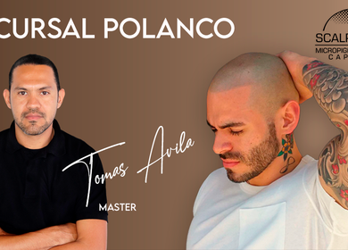 Micropigmentación Capilar No 1 en México - Scalp Real Studio CDMX