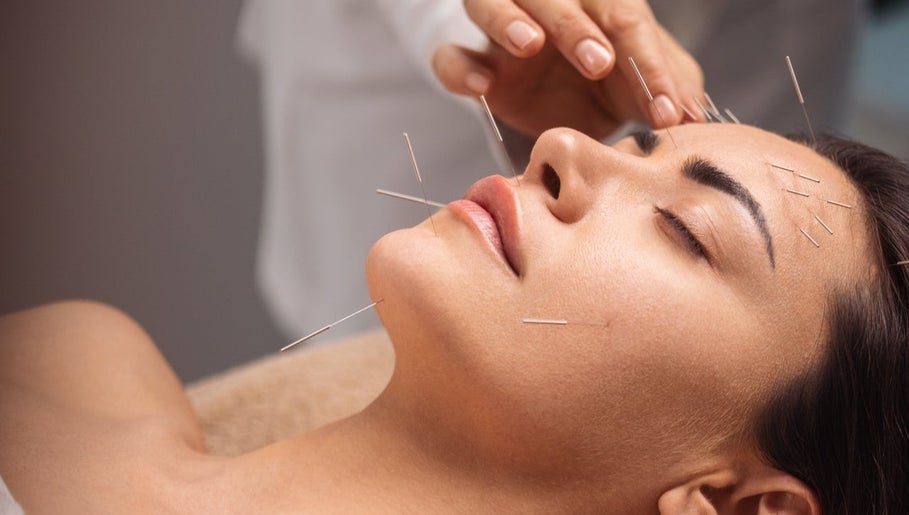 Acupuncture M.T.C. Semenou Brigitte