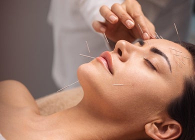 Acupuncture M.T.C. Semenou Brigitte