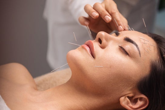 Imagem de Fisioterapia para Acupuncture M.T.C. Semenou Brigitte