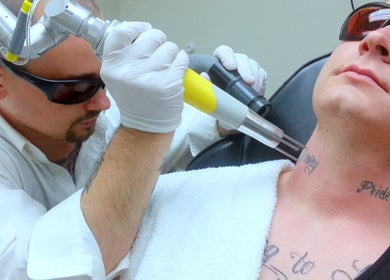 New Wave Laser Tattoo Removal