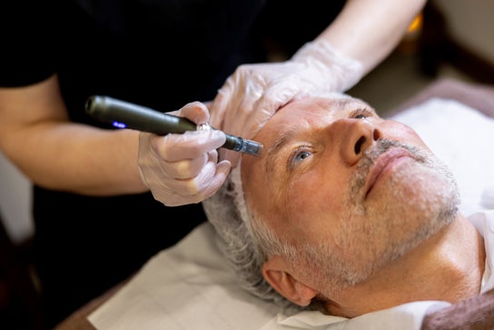 Aesthetics image for The Hair Loss Clinic | PRP Injections £145* | Microneedling