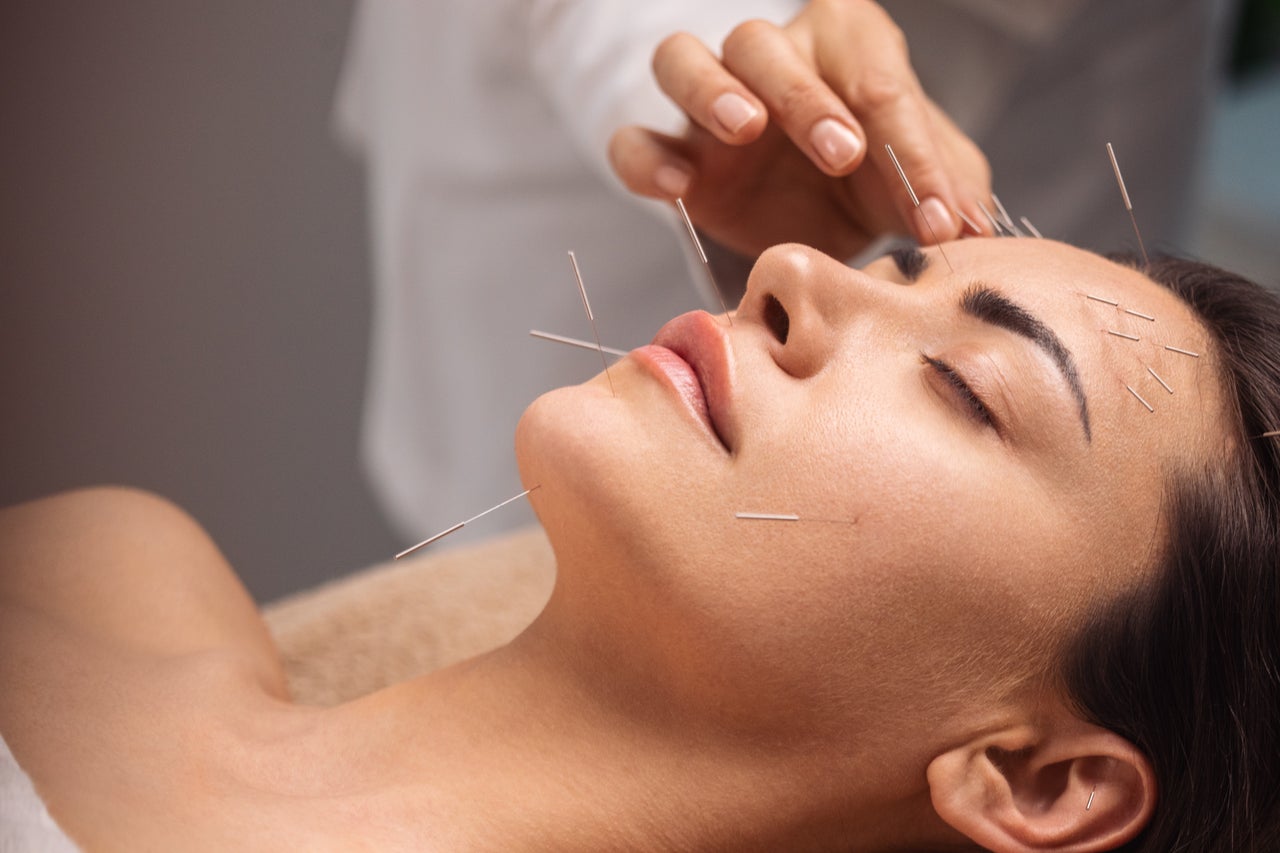 Experience the Best Acupuncture in Huntington Beach, CA