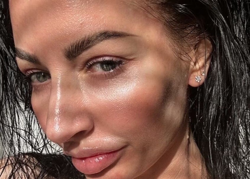 Close-up of glowing skin after treatment at Sknject, Rotherham, England, GB showcasing natural beauty.