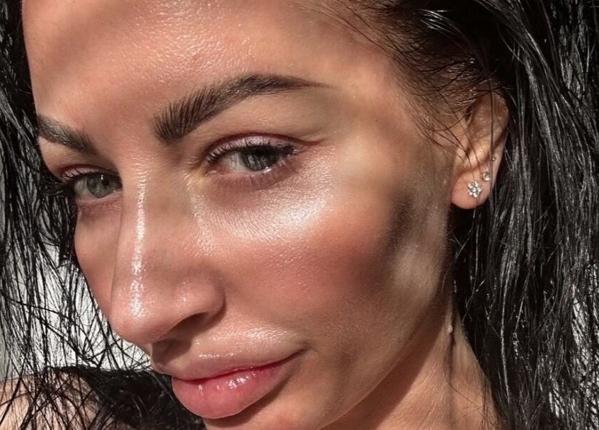 Close-up of glowing skin after treatment at Sknject, Rotherham, England, GB showcasing natural beauty.