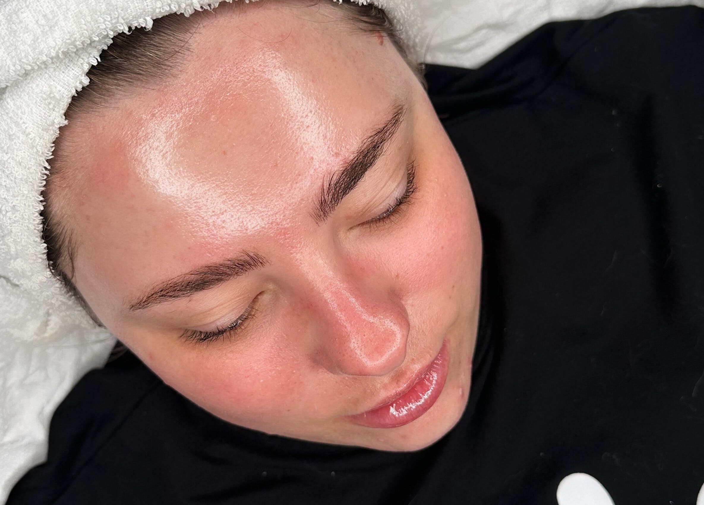 Facial treatment at Sknject in Rotherham, England, GB enhancing skin with a radiant glow.