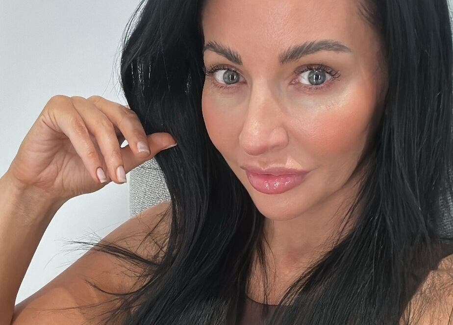 A person with radiant skin at Sknject, Rotherham, England, GB, showcasing beauty and wellness results.