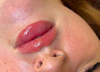 Glossy lips featured at Bows Beauty & Aesthetics, Bognor Regis, England, GB, showcasing expert beauty care.