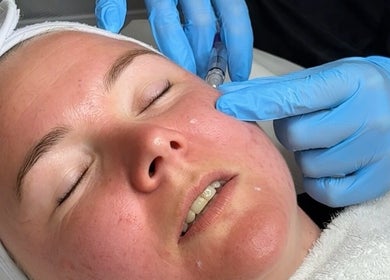 Facial treatment at Bows Beauty & Aesthetics in Bognor Regis, England, GB delivering skin rejuvenation.