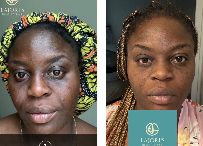 Before and after beauty treatment at Lajori’s Beauty Bar and Spa, Stockbridge, Georgia, US.