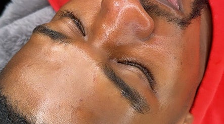 Venus Aesthetics obrázek 3