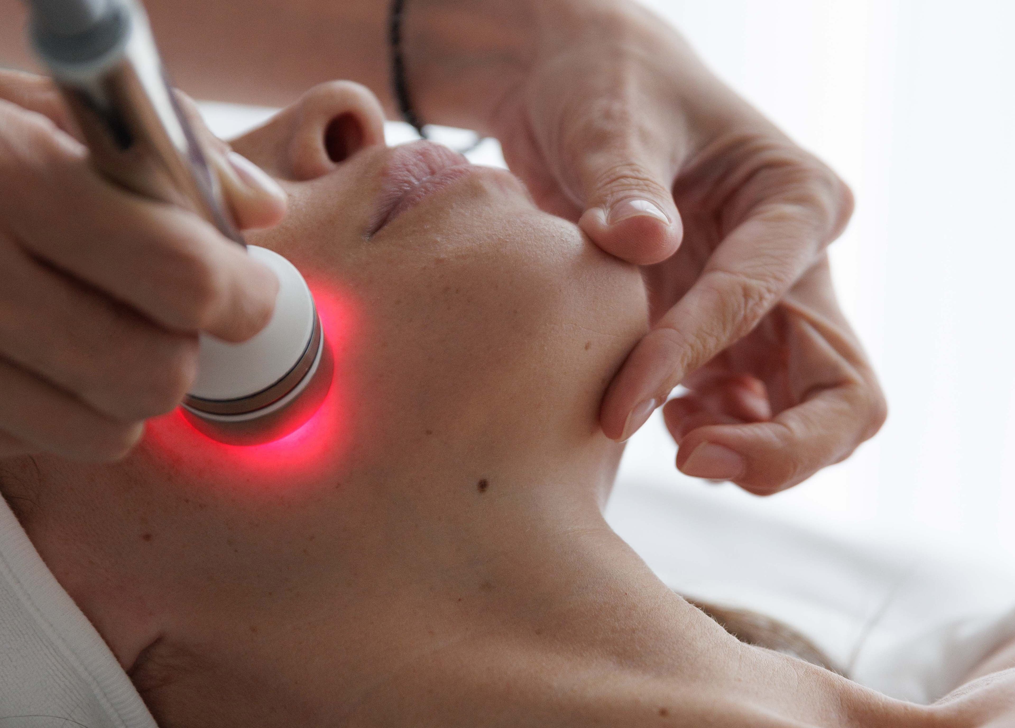 Luxusní léčba Amati Room v Bratislava, Bratislavský Kraj, SK, zobrazující obličejový laser.