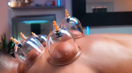 Cupping Massage Hijama Sloughの画像：3