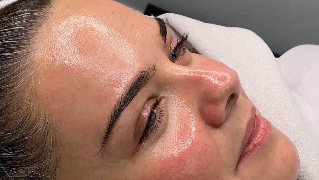 Close-up of a woman's face glowing after treatment at Dgtheaesthetician, London, England, GB.
