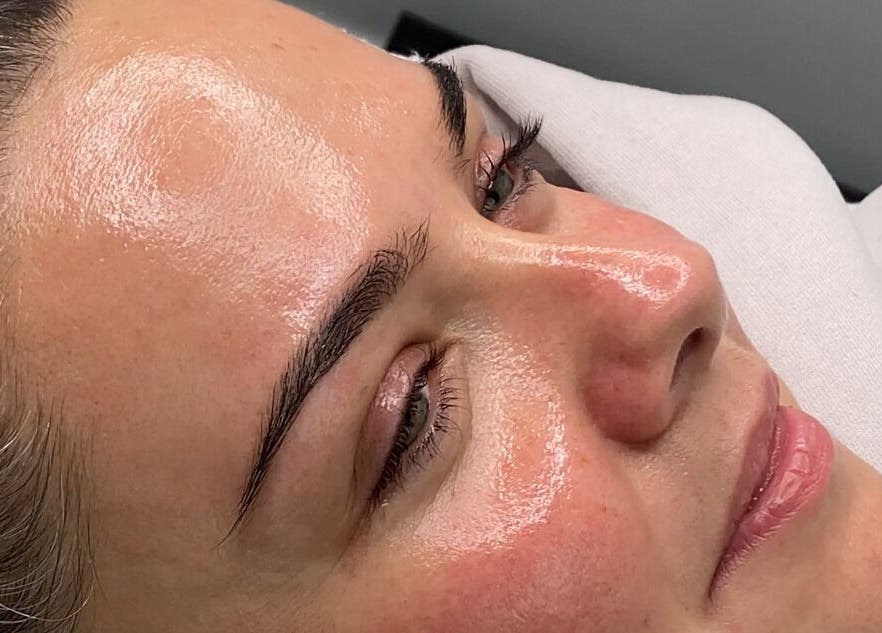 Close-up of a woman's face glowing after treatment at Dgtheaesthetician, London, England, GB.