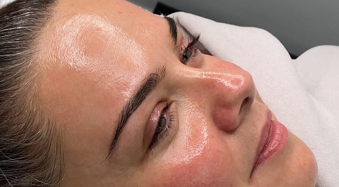 Close-up of a woman's face glowing after treatment at Dgtheaesthetician, London, England, GB.