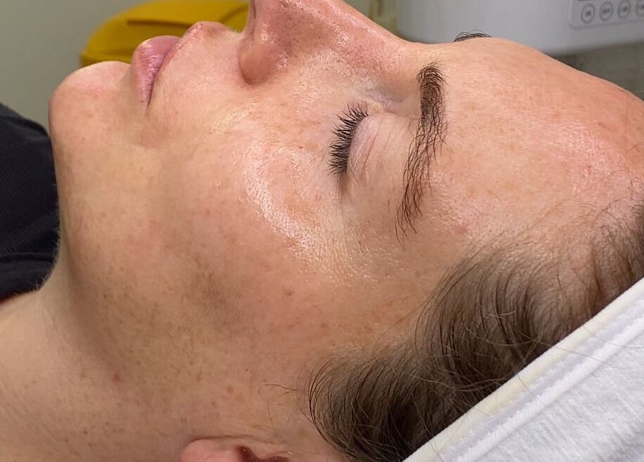 Relaxed woman at Dgtheaesthetician, London, England, GB, with smooth skin after a facial treatment.