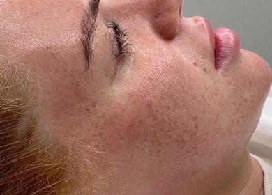 A close-up of a person's peaceful face during a facial treatment at Dgtheaesthetician, London, England, GB.