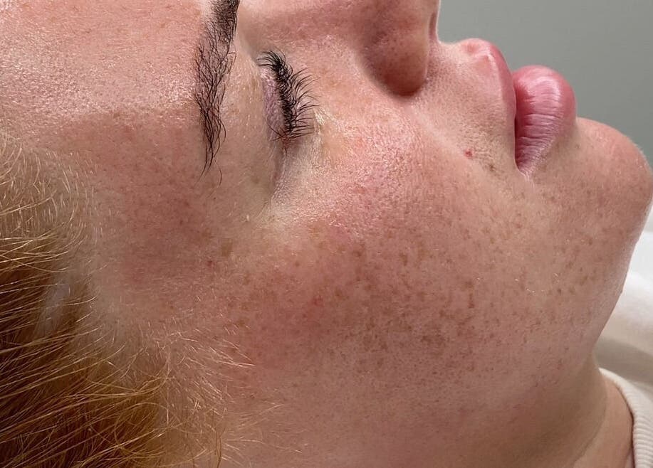 A close-up of a person's peaceful face during a facial treatment at Dgtheaesthetician, London, England, GB.