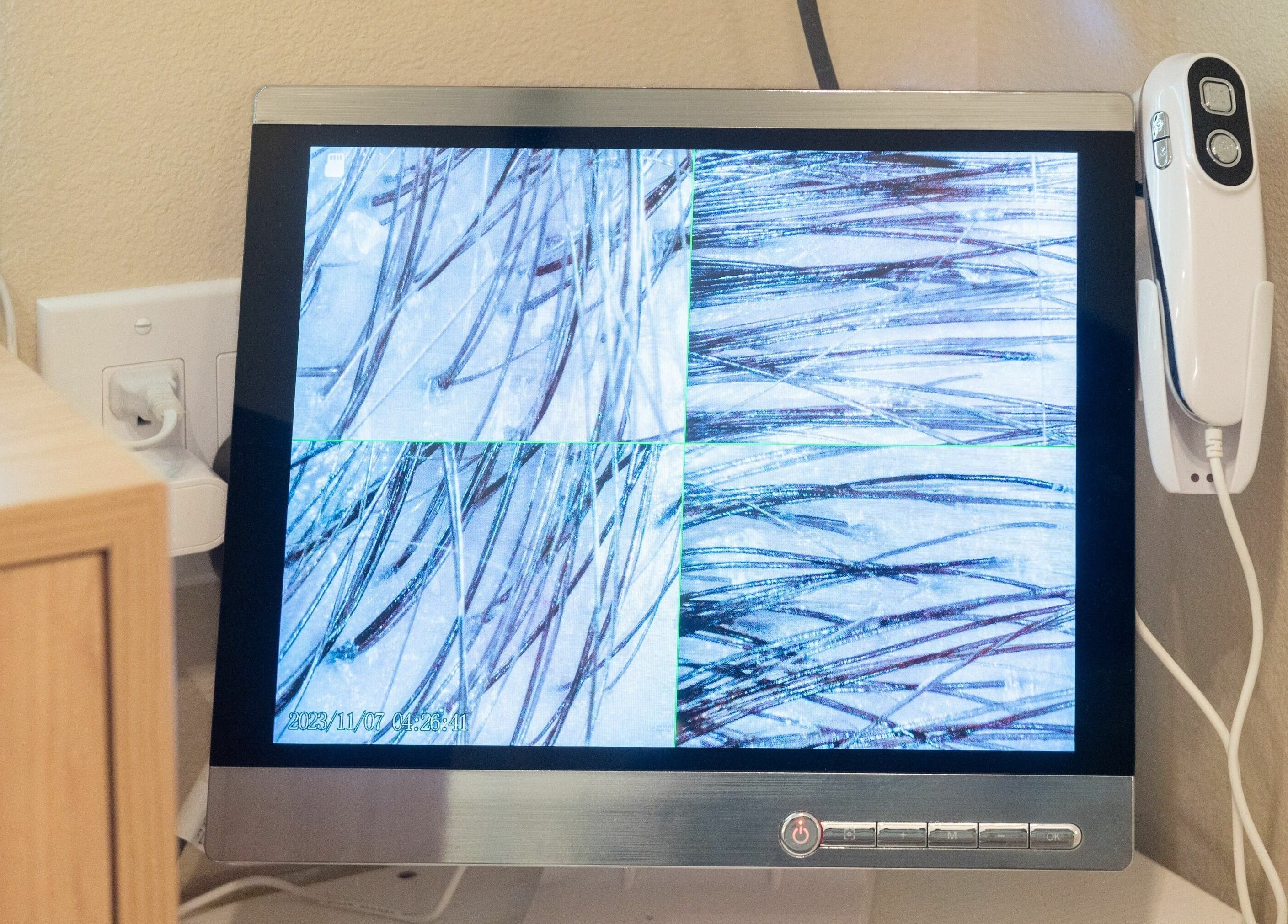 Hair analysis screen at Tea Scalp & Hair Spa in Las Vegas, Nevada, US showing detailed scalp images.