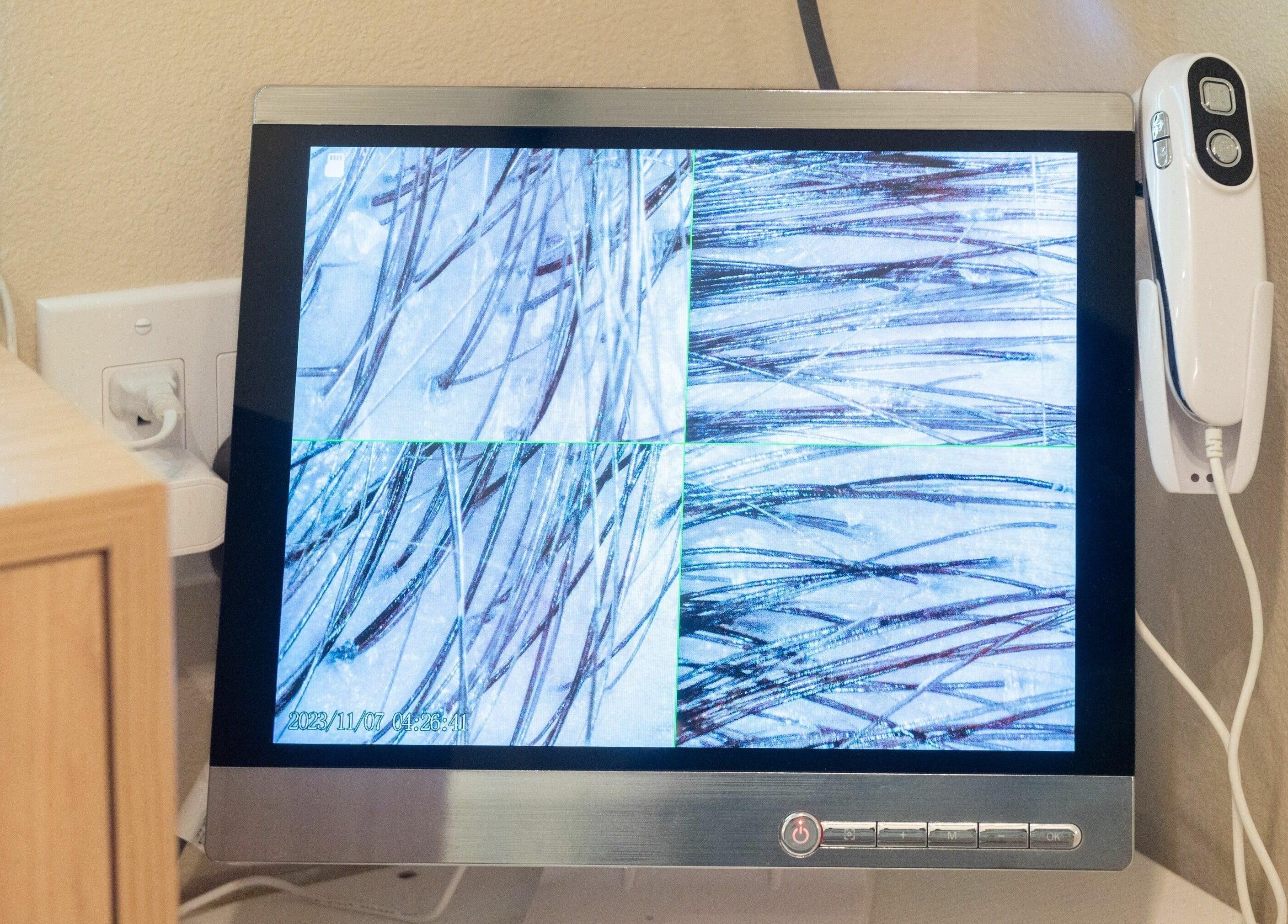 Hair analysis screen at Tea Scalp & Hair Spa in Las Vegas, Nevada, US showing detailed scalp images.