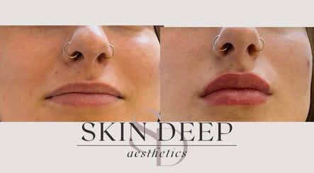 Skin Deep Aesthetics image 3