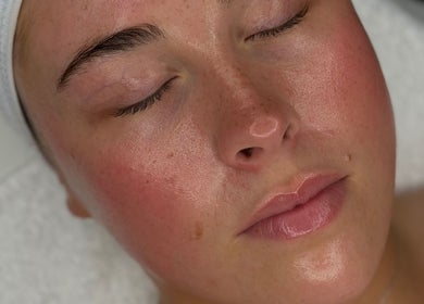 Close-up of a facial treatment at Cosmetics By Chlo, Westhoughton, England, GB highlighting smooth, glowing skin.