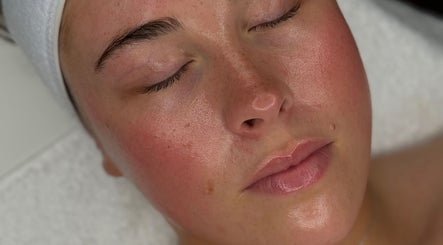 Close-up of a facial treatment at Cosmetics By Chlo, Westhoughton, England, GB highlighting smooth, glowing skin.