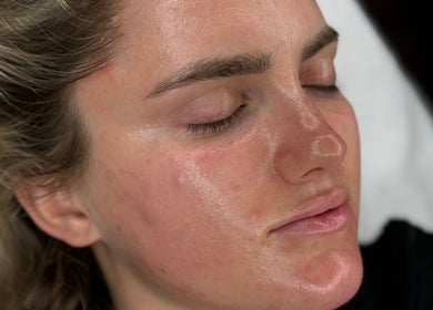 Close-up of a serene face with glowing skin after a facial at Cosmetics By Chlo, Westhoughton, England, GB.