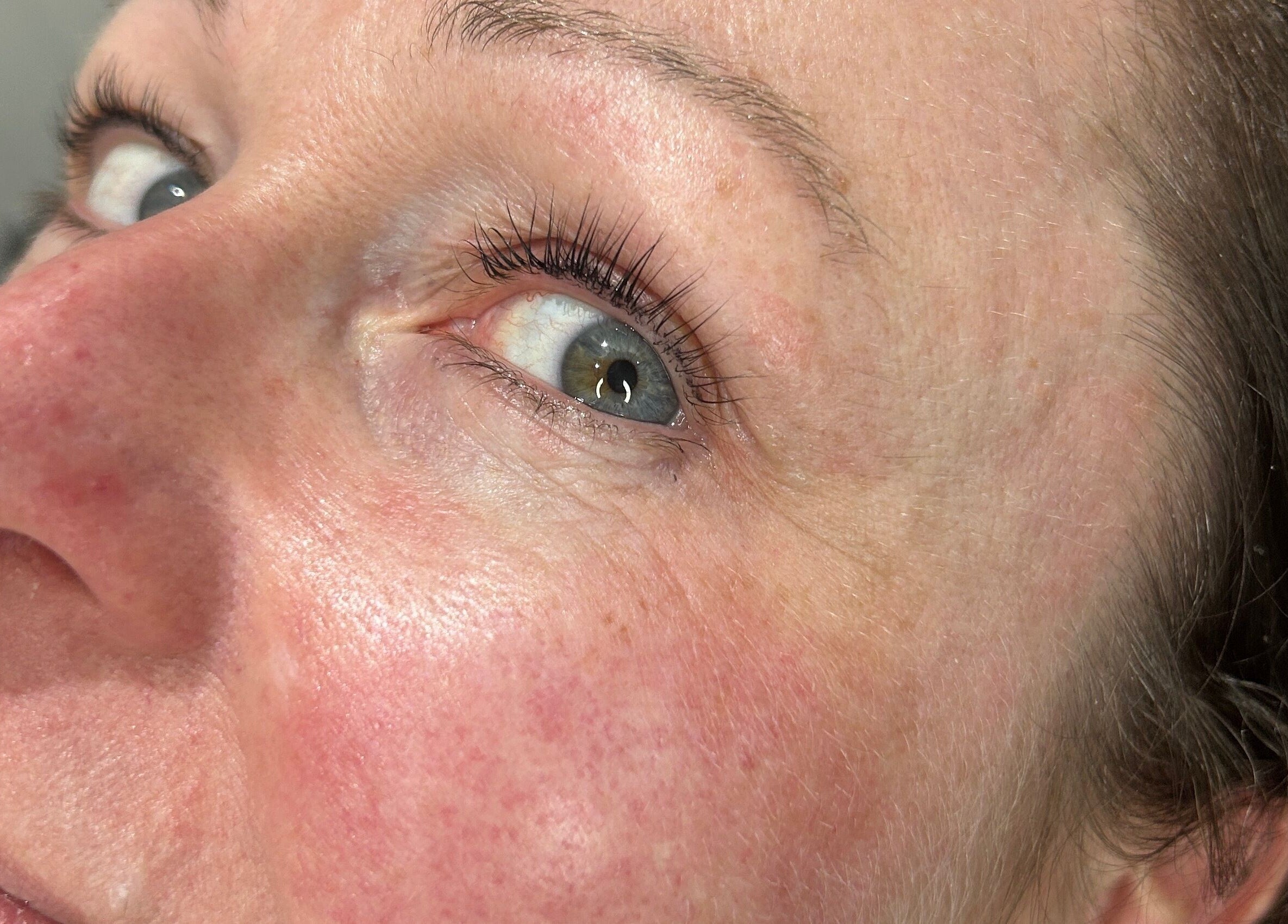 Closeup of skin treatment at Glow Salon, Salford, England, GB showcasing smooth, radiant skin.