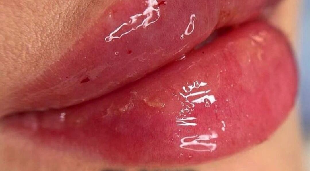 Close-up of glossy, enhanced lips at CARDIFF BAY beauty venue, Cardiff, Wales, GB.