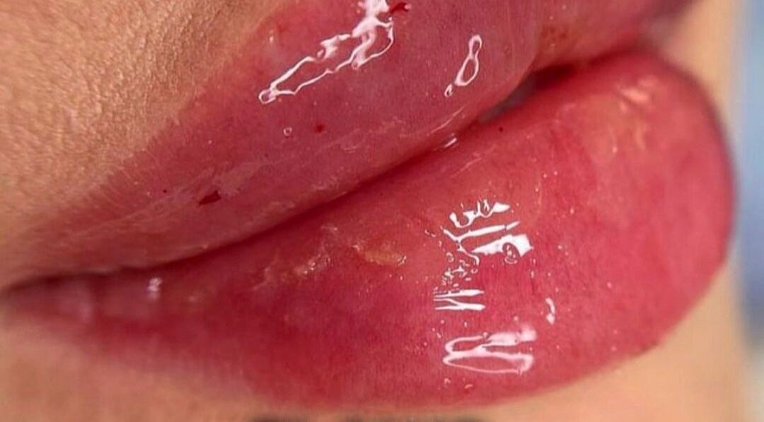 Close-up of glossy, enhanced lips at CARDIFF BAY beauty venue, Cardiff, Wales, GB.