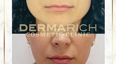 Dermarich Cosmetic Clinic изображение 3