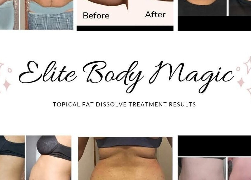 Before and after body transformation results at Lay Zay Body and Spa, Garland, Texas, US.