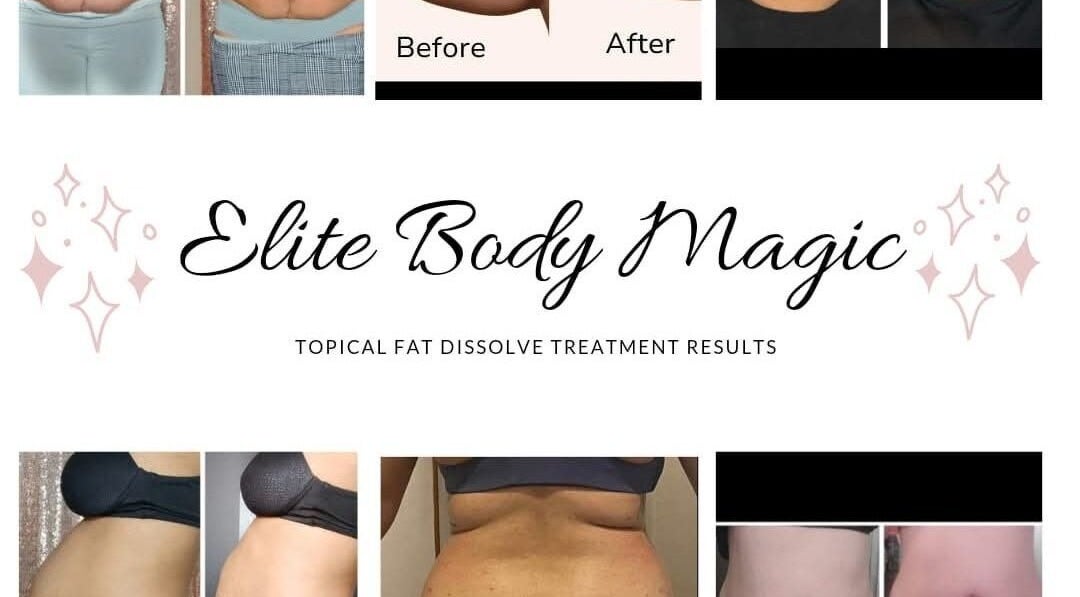 Before and after body transformation results at Lay Zay Body and Spa, Garland, Texas, US.