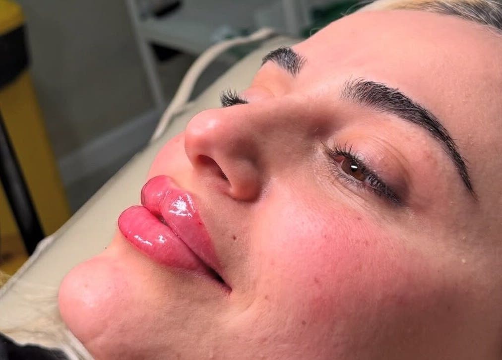 Glossy lip enhancement by Tweaked By Tyler in Leeds, England, GB with a close-up on vibrant, shiny lips.