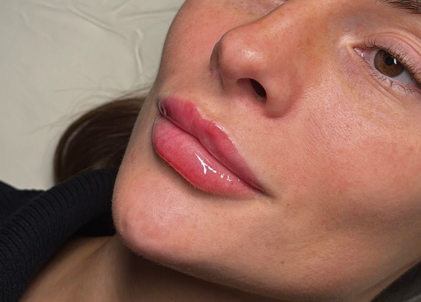 Close-up of glossy lips after treatment at Tweaked By Tyler, located in Leeds, England, GB.