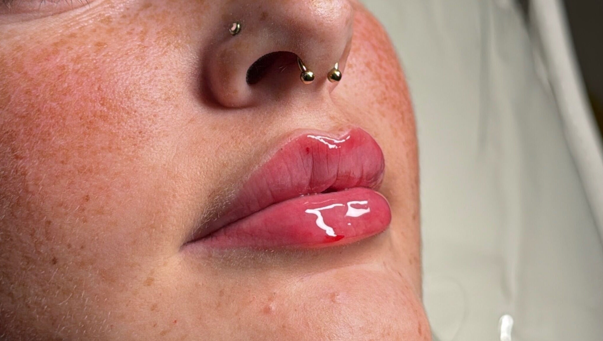 Close-up of glossy, enhanced lips at Tweaked By Tyler in Leeds, England, GB, showcasing beauty treatment results.