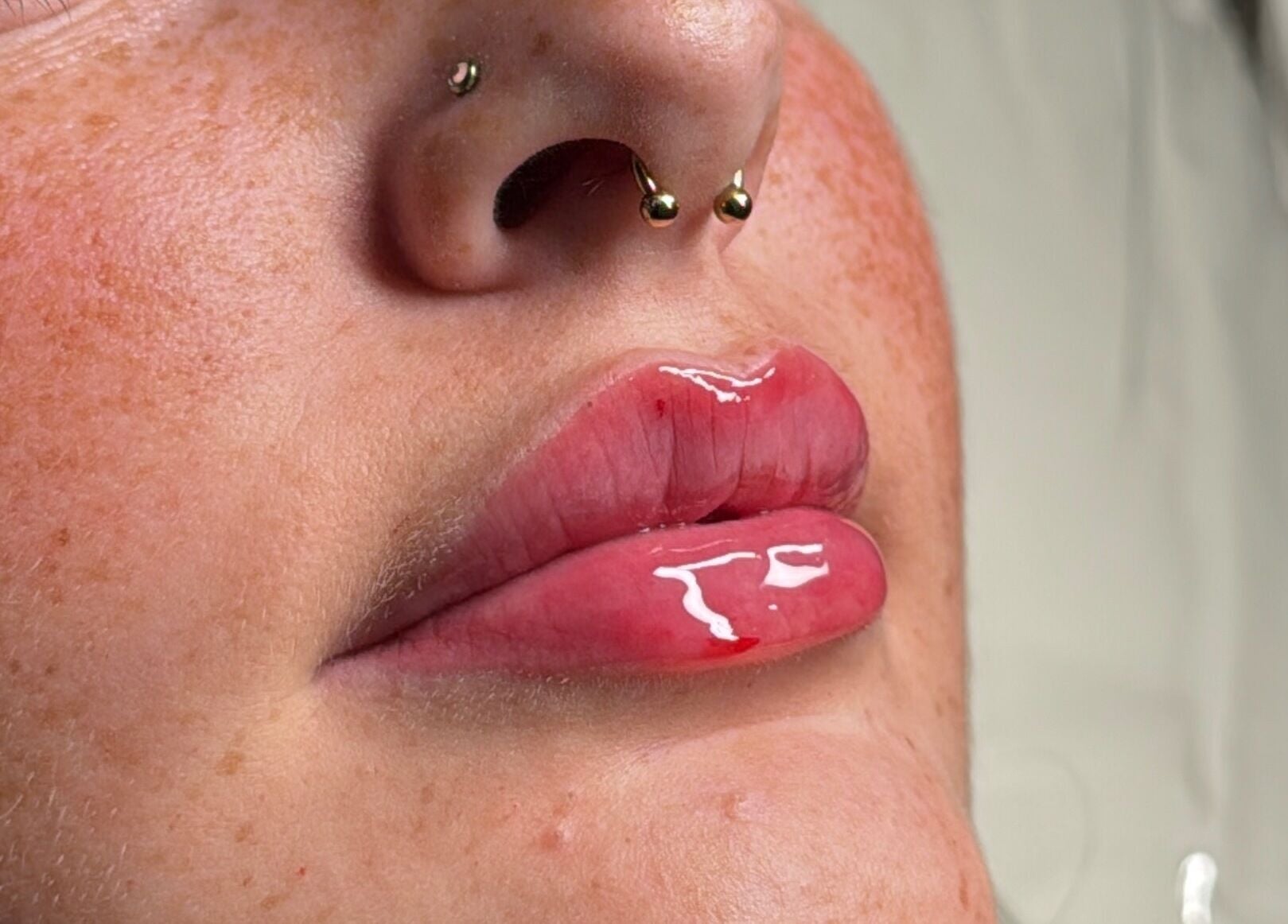 Close-up of glossy, enhanced lips at Tweaked By Tyler in Leeds, England, GB, showcasing beauty treatment results.