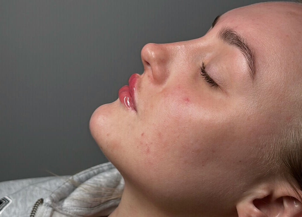 Relaxed face with glowing skin at Tweaked By Tyler in Leeds, England, GB delivering exceptional skincare.