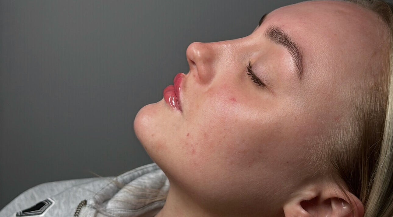 Relaxed face with glowing skin at Tweaked By Tyler in Leeds, England, GB delivering exceptional skincare.