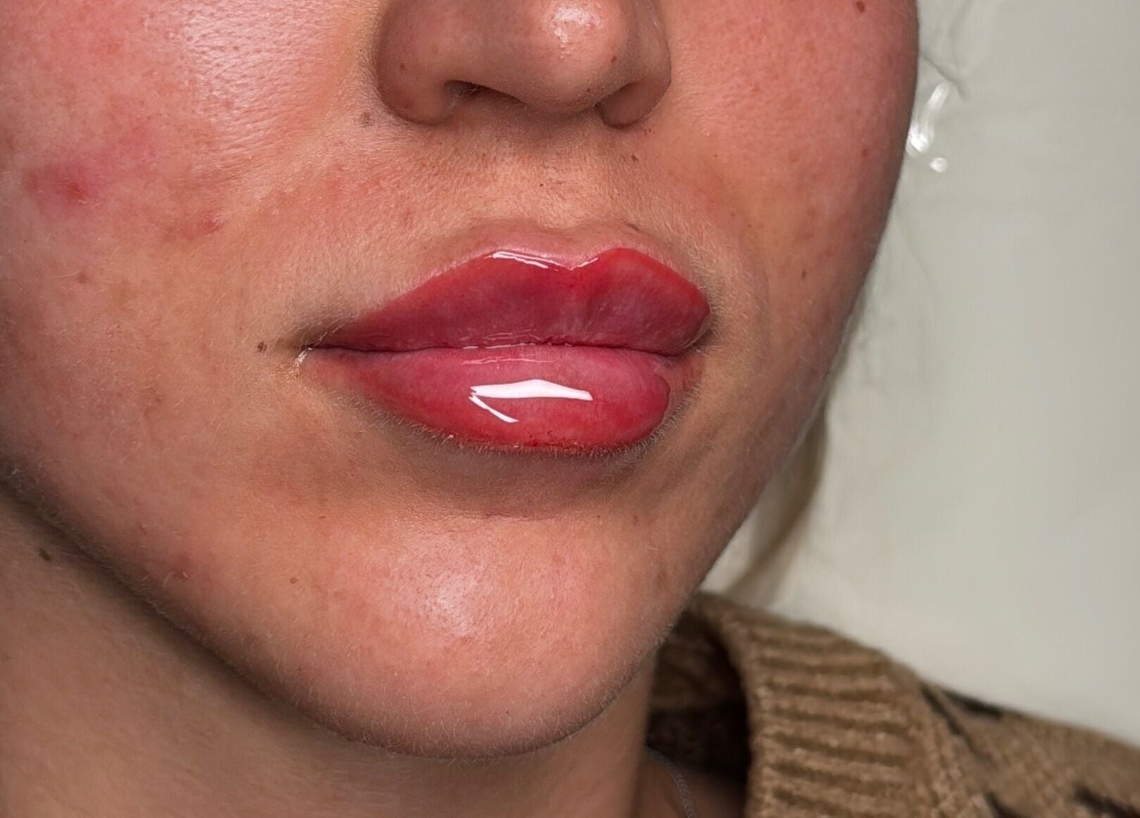Close-up of glossy lips after treatment at Tweaked By Tyler, Leeds, England, GB.