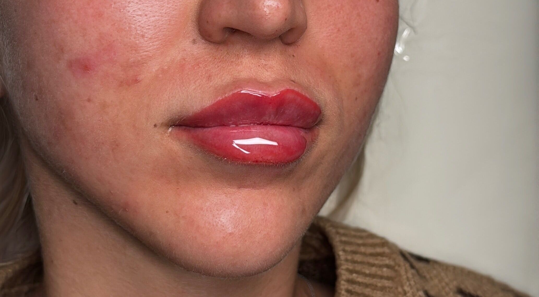 Close-up of glossy lips after treatment at Tweaked By Tyler, Leeds, England, GB.