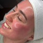 The Skin Spa