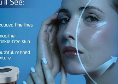 Achieve smoother, wrinkle-free skin at Dalia Aziz Aesthetics, Verdun, Beirut Governorate, LB.