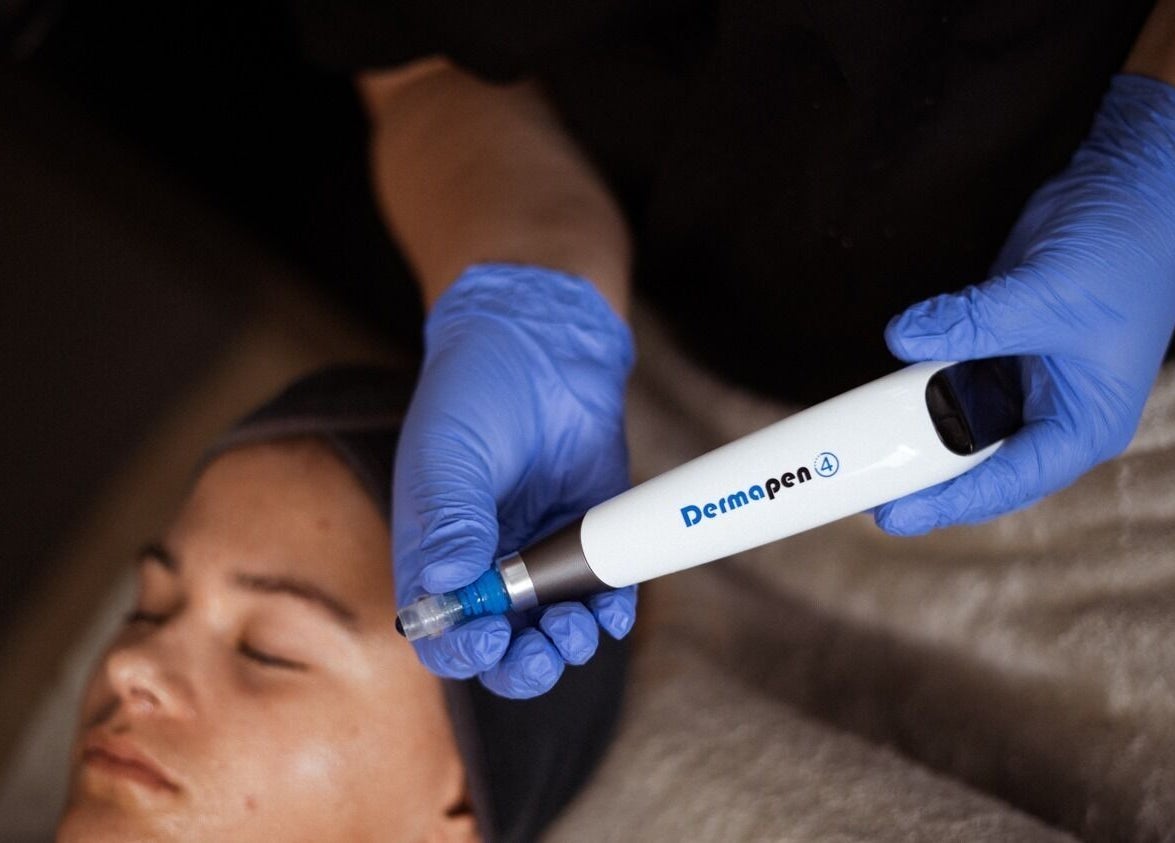 Dermapen facial treatment in progress at Aqua Spa and Skin, 14 Dr BB Keet Street, Noorsekloof, J-Bay, Jeffreys Bay, Eastern Cape, ZA.