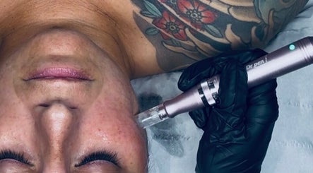 Microneedling treatment at Sacred Roots Limited in Guernsey, Vale, GG. Close-up of facial rejuvenation process.