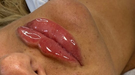 Glossy lips after beauty treatment at Honeys Beauty Galore, London, England, GB.